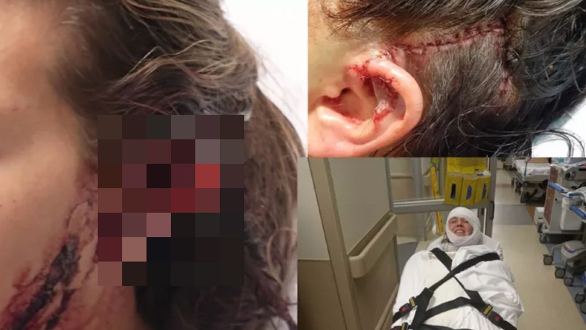 Ohio woman deer attack photos