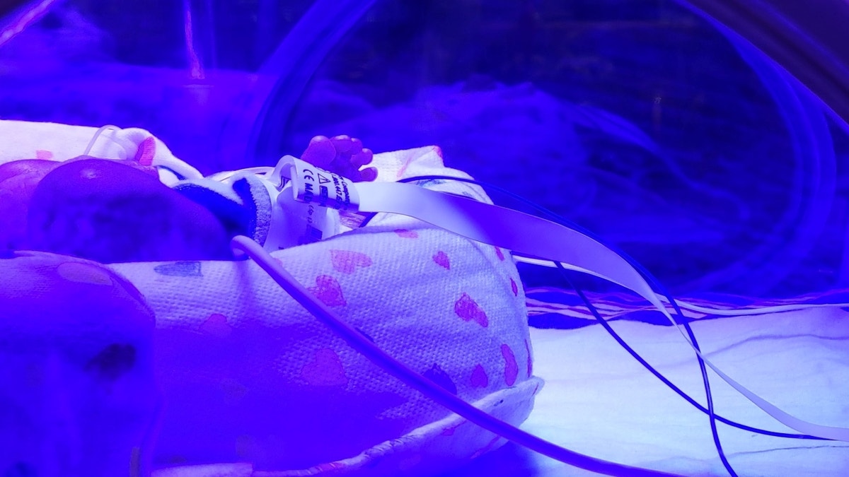 NICU baby laying in incubator