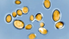 Frightening new fungus 'candida auris': What is it? Who is susceptible?