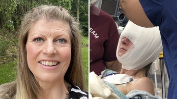 Bear attacks woman who's walking her dogs, she plays dead even with 'crunched' skull