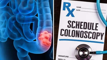 Health expert, citing 'grave concern,' says results of new colonoscopy study are 'widely' misinterpreted