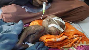Child malnutrition ravages Central Somalia with nation on brink of famine