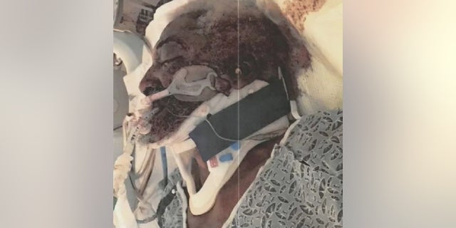 Jerry Blasingame is expected to receive at least $40 million from the city of Atlanta after an encounter with a police officer left him paralyzed and badly injured.