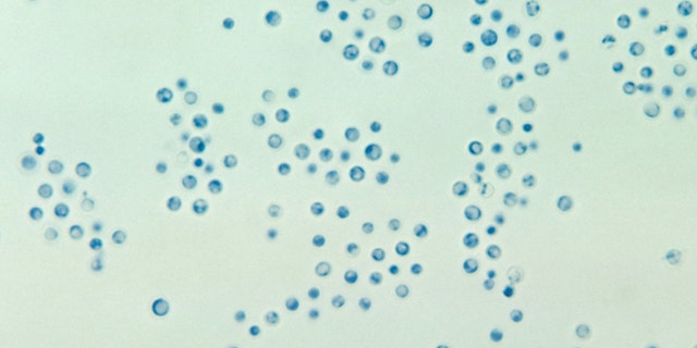 Photomicrograph of the encapsulated yeast Cryptococcus neoformans, 1961. Image courtesy Centers for Disease Control and Prevention (CDC) / Dr Lucille K. Georg. 