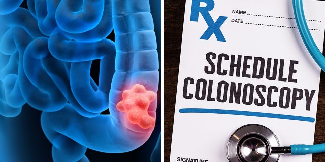 "This study was just not designed to evaluate the efficacy of colonoscopy," Knudsen said of the new study just published.