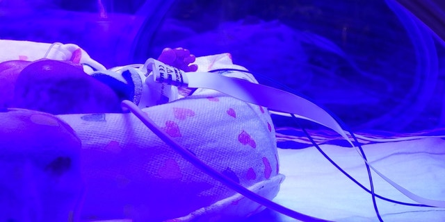 A NICU baby lies in an incubator at a hospital.