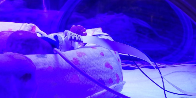 A NICU baby lies in an incubator at a hospital.