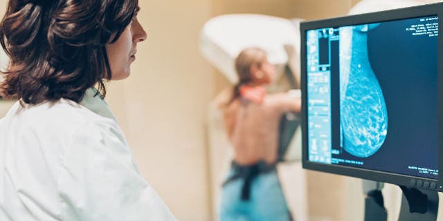 A mammogram uses x-ray images to detect breast cancer.