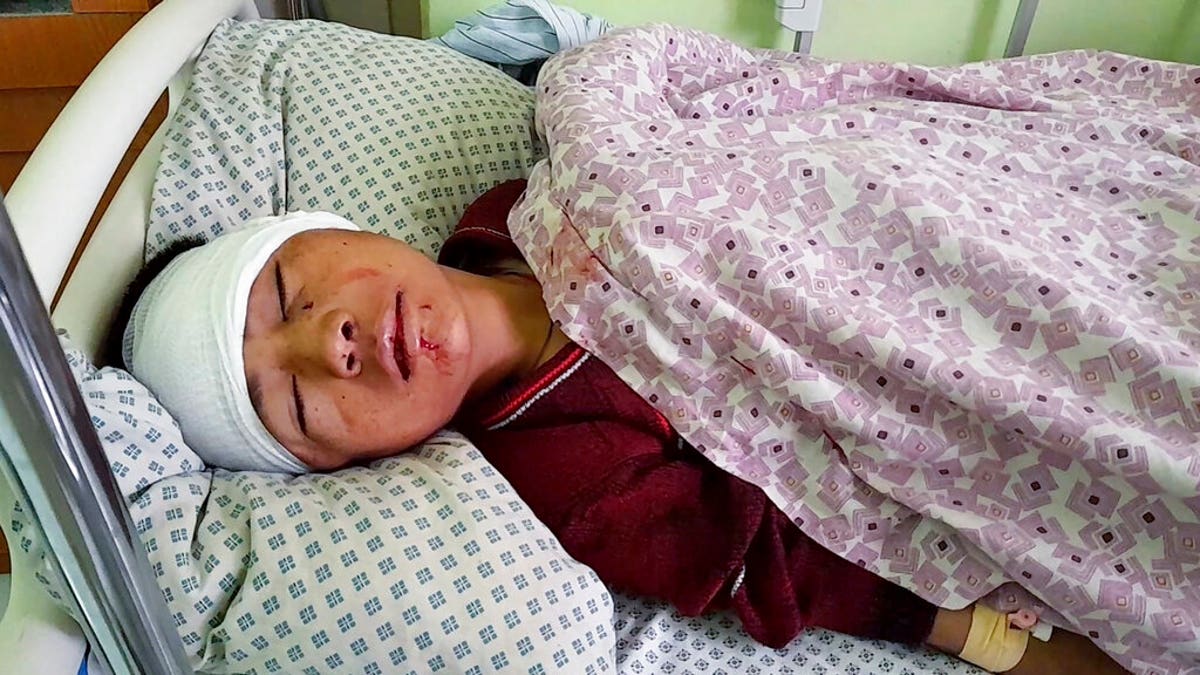 Afghanistan explosion victim in hospital bed