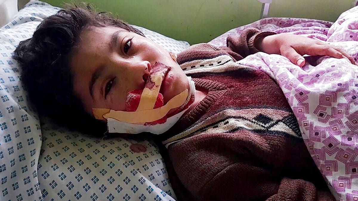 Afghanistan explosion victim