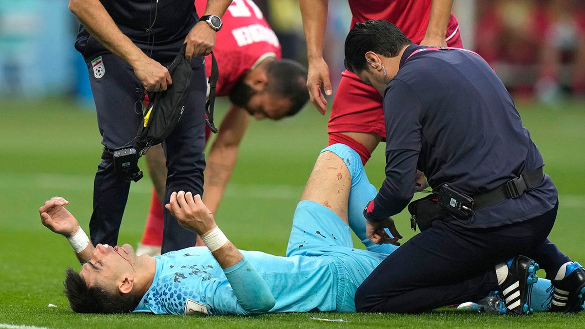 Alireza Beiranvand bloodied nose