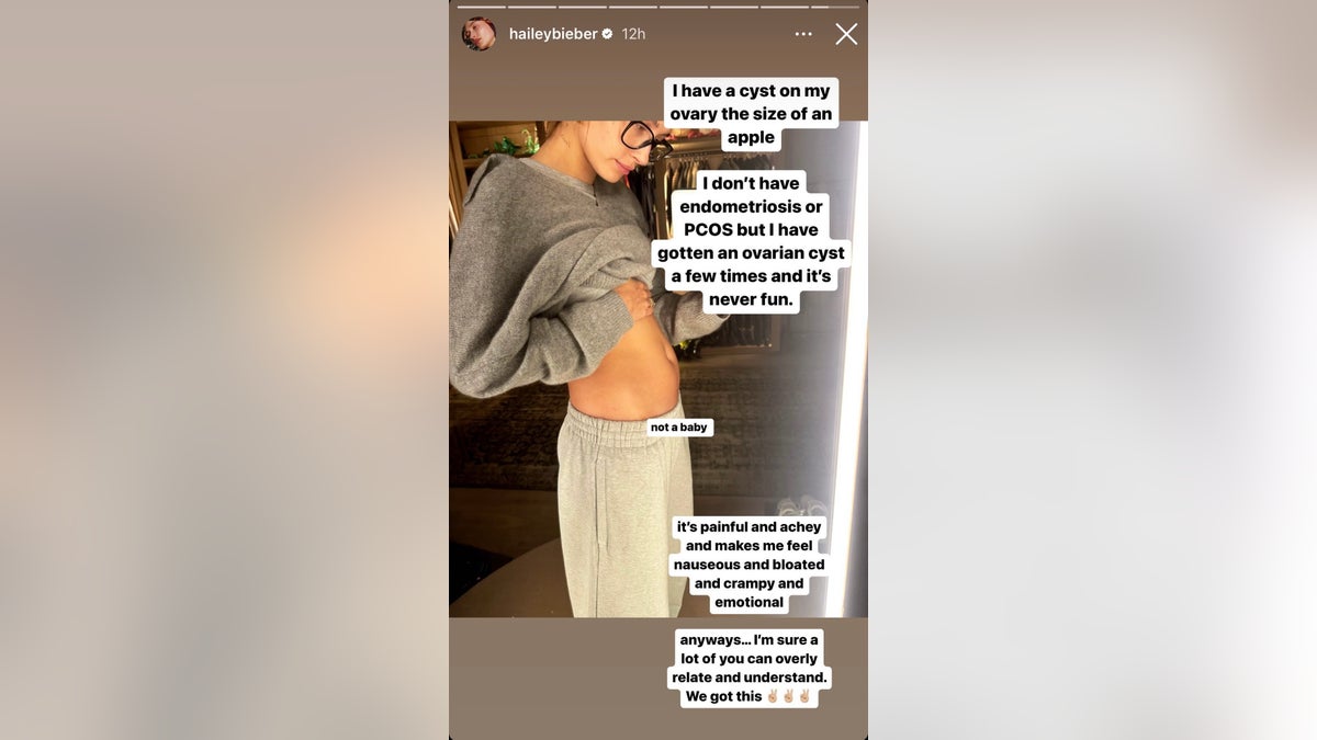 Hailey Bieber lifted up her shirt to reveal a small bump on her stomach which is an ovarian cyst
