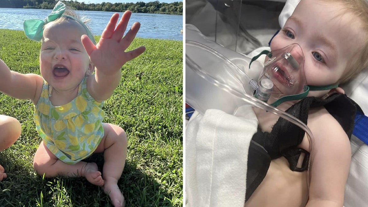 Side-by-side photo of Kinsley Bremiller pre- and post-RSV.