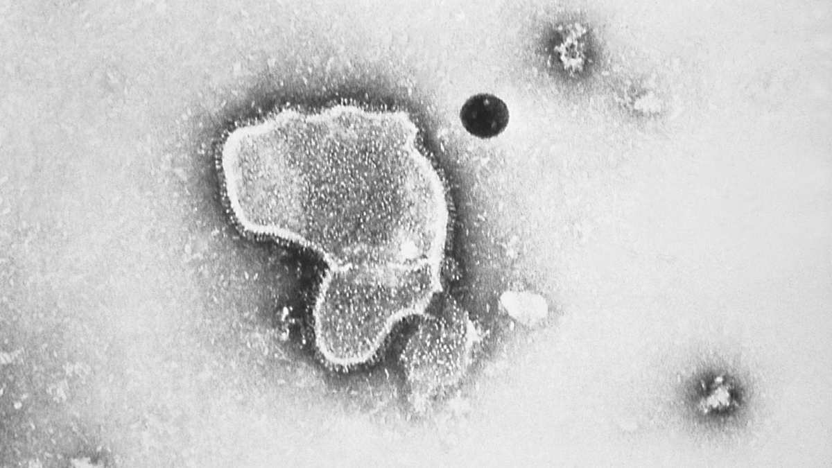 RSV virus