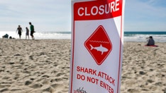 California woman describes shark attack: 'I saw it clamp on my leg'