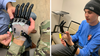 Veteran of US Army regains ability to move fingers with new procedure, prosthetics: Hope for 'normal future’