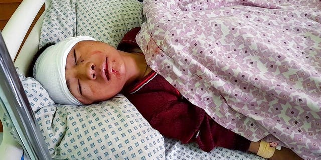 A wounded boy receives treatment at a hospital after a deadly bomb blast at a religious school in Aybak, the capital of the Samangan province in northern Afghanistan, Wednesday, Nov. 30, 2022. The blast Wednesday at a madrassa killed at least 10 students and wounded several others, a Taliban official said.
