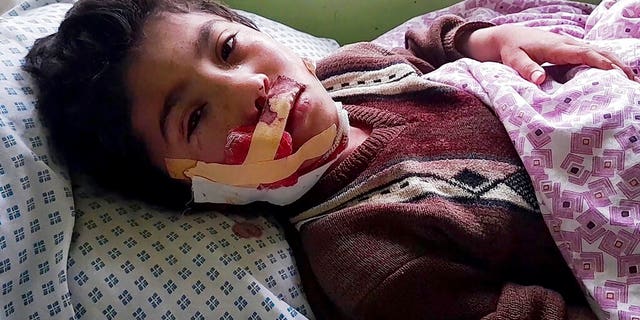A wounded boy receives treatment at a hospital after a deadly bomb blast at a religious school in Aybak, the capital of the Samangan province in northern Afghanistan, Wednesday, Nov. 30, 2022. The blast Wednesday at a madrassa killed at least 10 students, a Taliban official said.