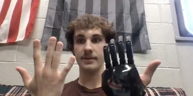Jackson Schroeder shows off his prosthetic hand during an on-camera interview with Fox News Digital on November 7, 2022. 