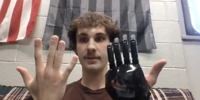 Jackson Schroeder shows off his prosthetic hand during an on-camera interview with Fox News Digital on November 7, 2022.