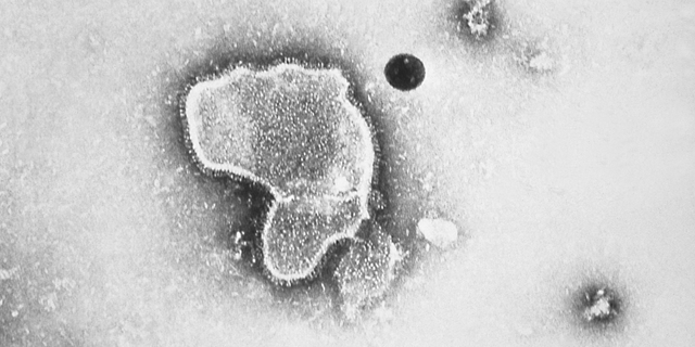 This transmission electron micrograph reveals the morphological features of respiratory syncytial virus (RSV) in 1981. 