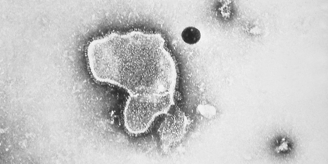 This transmission electron micrograph reveals the morphologic traits of the Respiratory Syncytial Virus (RSV), 1981. 