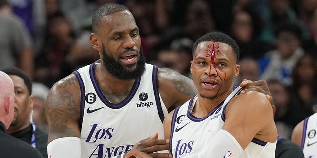 Los Angeles Lakers guard Russell Westbrook's forehead is bleeding profusely after being fouled by Spurs forward Zach Collins, Nov. 26, 2022, in San Antonio, Texas.