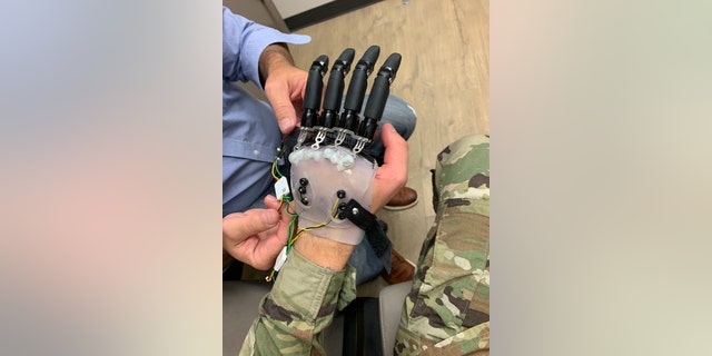 Zoom on one of Jackson Schroeder's prosthetic hands.