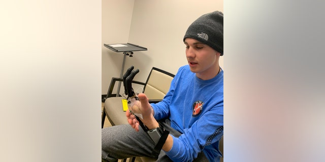 Army veteran Jackson Schroeder tries on his prosthetic hand after receiving the Starfish procedure, thanks to Drs. Glenn Gaston and Bryan Loeffler. He was the first veteran in the United States to benefit from the new procedure.