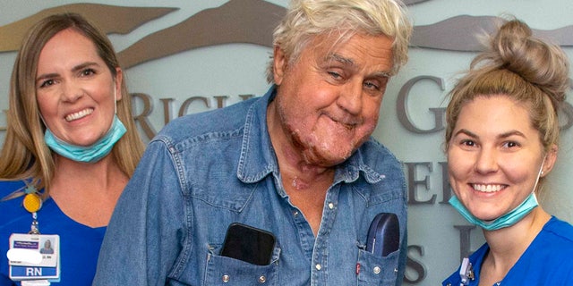 Leno reveals the burns he suffered from a garage fire as he leaves the Grossman Burn Center in West Hills, California.
