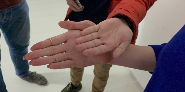 KARABUK, TURKIYE - APRIL 3: 25-year-old Turkish woman Rumeysa Gelgi shows her hand as she makes a press statement on her applications setting new records at Guinness World Records in Karabuk, Turkiye on April 3, 2022. Rumeysa Gelgi was given the title of the world's tallest living woman, standing at 215.16cm (7ft 0.7in) by Guinness World Records in 2021. She, a month ago, received the titles of "woman with the world's largest hands", "woman with the world's the longest fingers" and "woman with the world's the longest back". (Photo by Orhan Kuzu/Anadolu Agency via Getty Images)