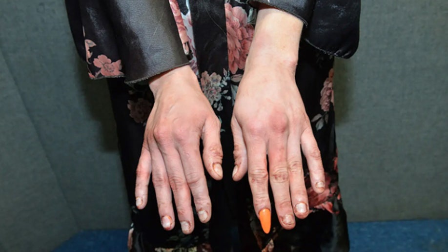 A single orange painted acrylic nail can be seen on Clenney's hands.