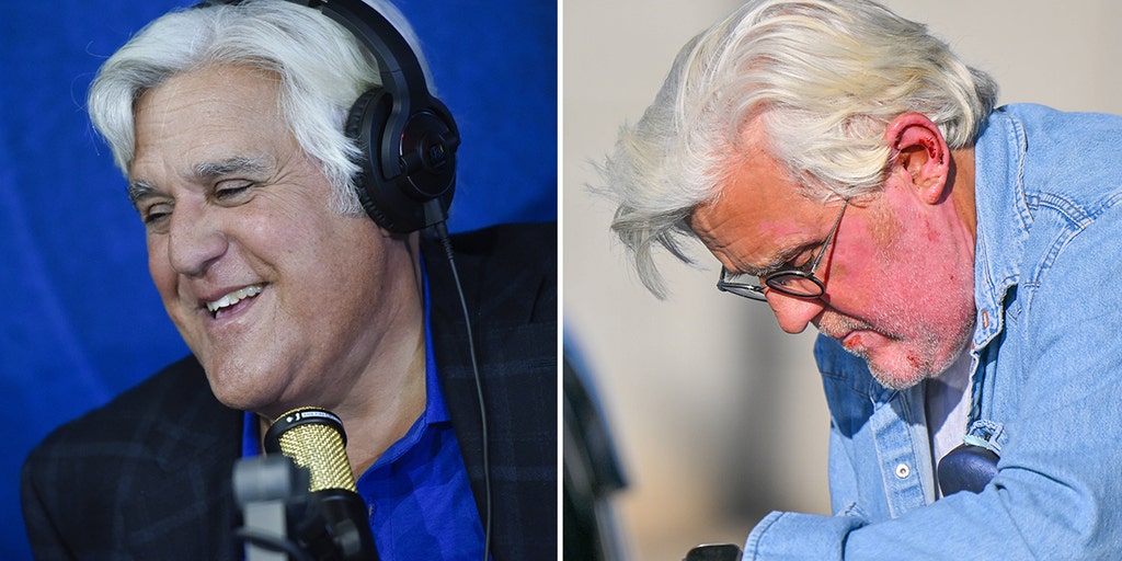 Jay Leno wants to joke about his facial burns: 'There's nothing worse than whiny celebrities' - Vimarsana News