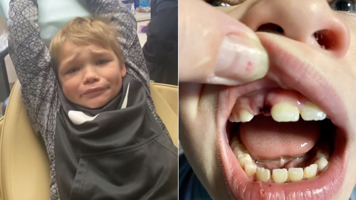 Easton Johnson shown with a tooth missing