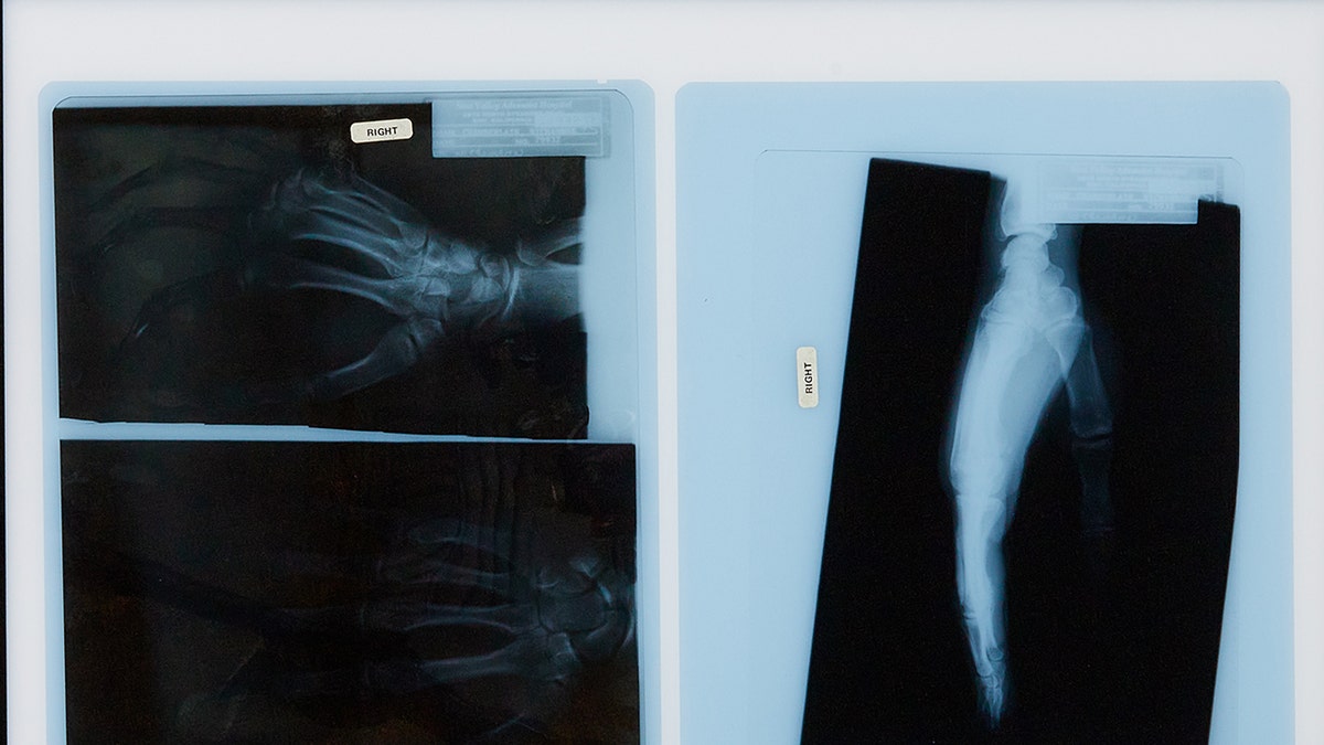 Richard Chamberlain's x-rays