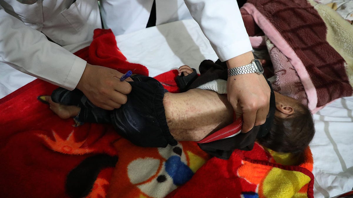 child suffering from measles in Afghanistan