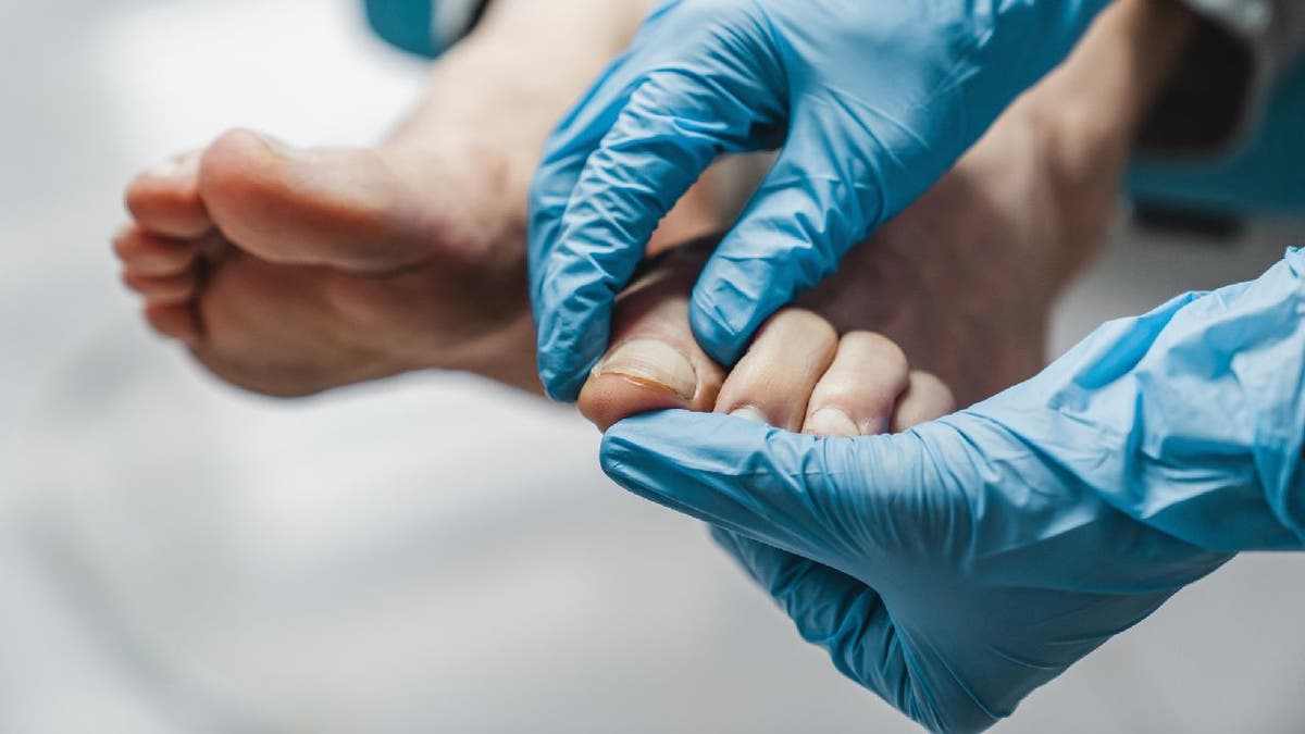 Doctor looks at person's infected toe nail