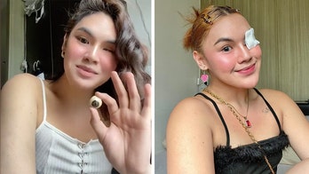 'Eye' on life: Woman goes viral for showing how she inserts artificial eye after cancer battle