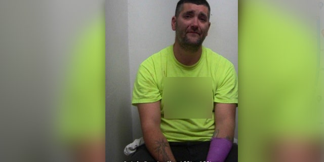 James Curtis Leonard's newest mugshot shows a bandage on his left arm, where he allegedly slashed himself in a domestic altercation with his wife.