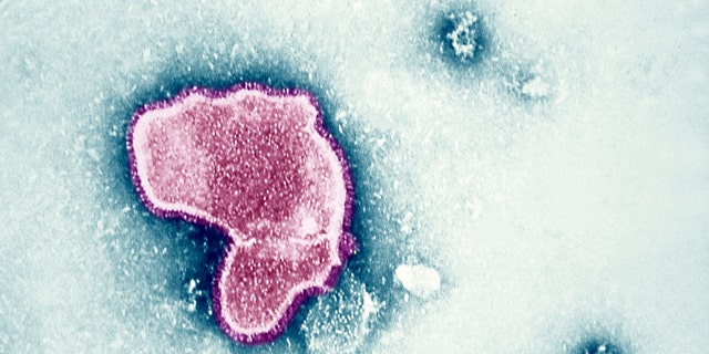 Electron micrograph showing morphological features of respiratory syncytial virus (RSV). 