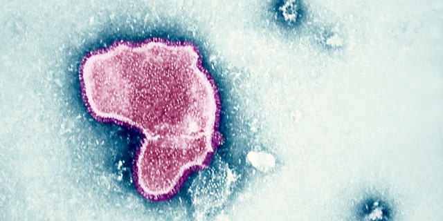 An electron micrograph reveals the morphologic traits of the respiratory syncytial virus (RSV).