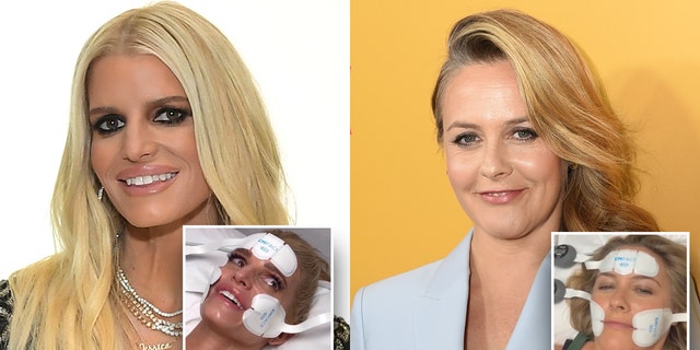 Jessica Simpson and Alicia Silverstone are just a few Hollywood stars wading in the waters of non-invasive cosmetic procedures.