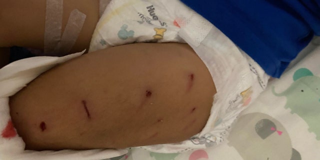 Mother Shira Eliyahuo and father Ariel say their daughter suffered scratches and was treated in an emergency room after she was attacked by a coyote on Dec. 2, 2022. 