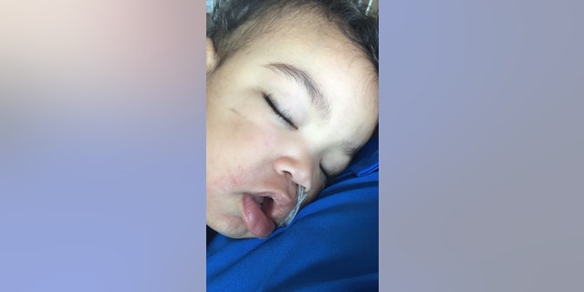 Kipley Haugen pictured here. Though the beads are labeled "non-toxic," Kipley experienced permanent damage, mom Ashley Haugen said.