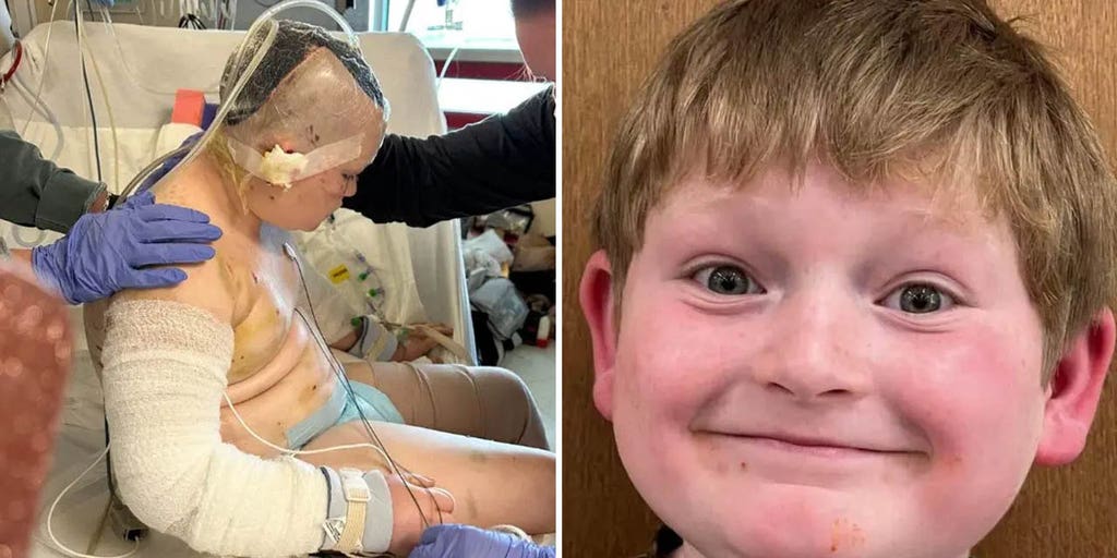 Facebook community rushes to aid Georgia boy who was mauled by three pit bulls - Vimarsana News