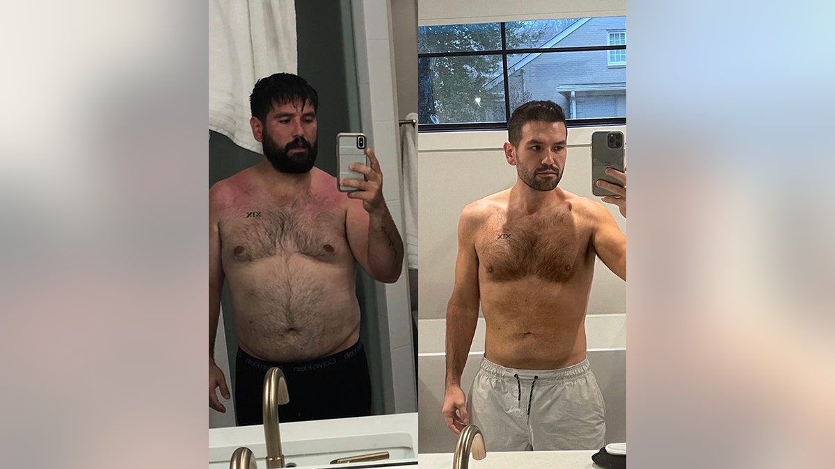 Shay Mooney shows off his 50-pound weight loss in a side-by-side photo he posted to Instagram where he is shirtless in both pictures