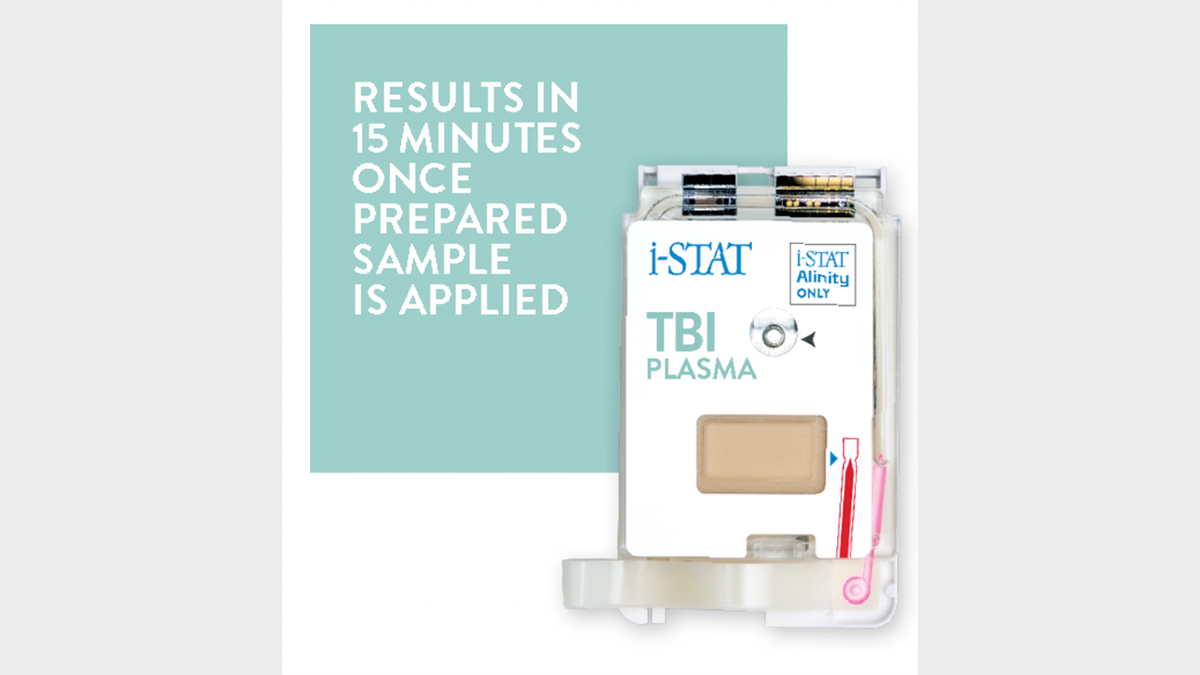 concussion test plasma cartridge abbott