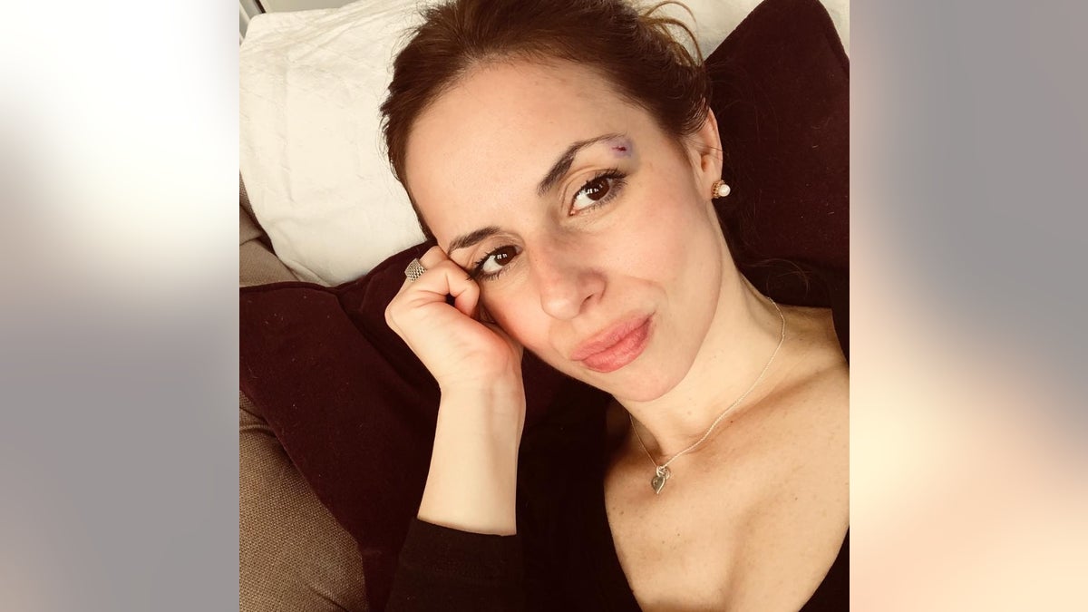 Ana Walshe Instagram injury post