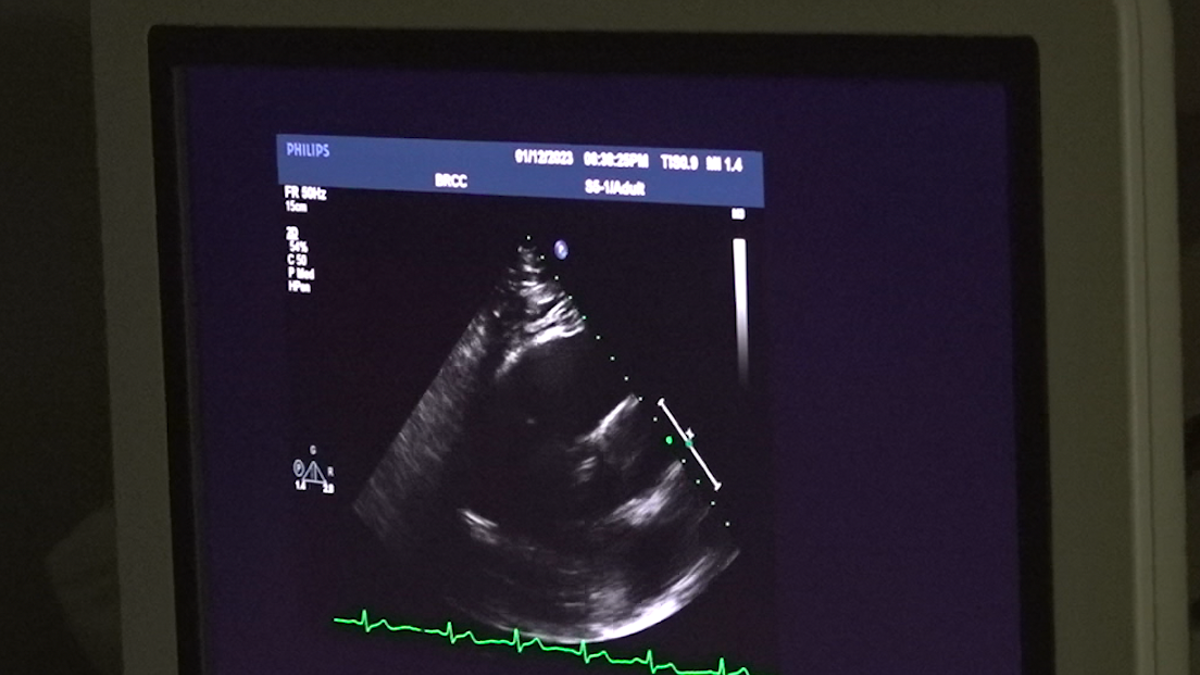 Echocardiogram screen of human heart