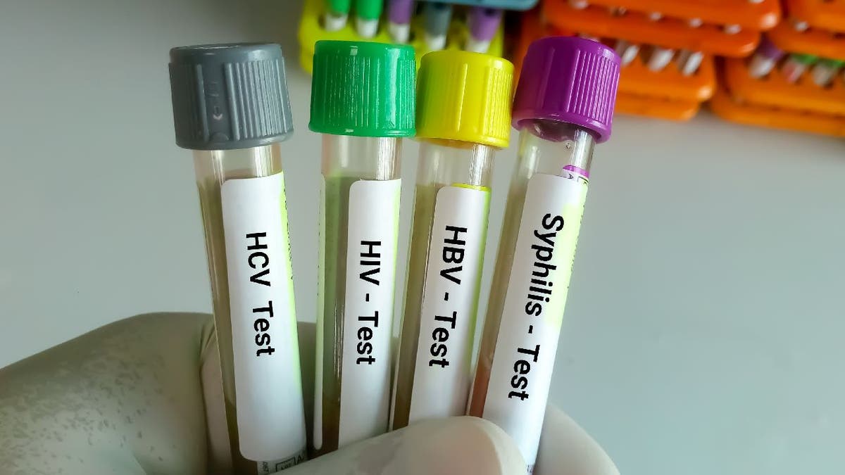 Four STD test samples